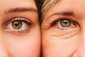aging-skin-concerns: close up of mother and daughter eyes