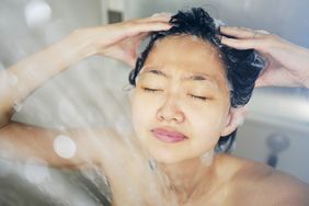 does-dandruff-shampoo-help-acne-GettyImages-1256729628