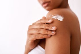 dry-skin-facts: woman applying lotion to skin