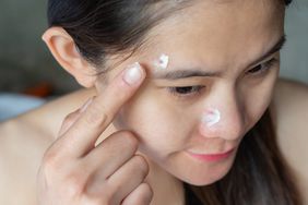 how-to-treat-acne-with-aspirin-GettyImages-1269780683