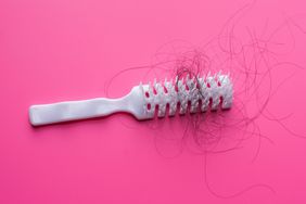 too-much-hair-loss: brush with hair in it