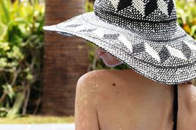 Woman with birthmarks on her back .